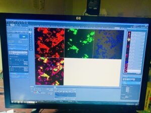 Confocal microscopy images of Drosophila hemocytes stained with nuclear and cytoplasmic markers